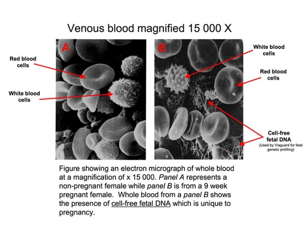 prenatal paternities